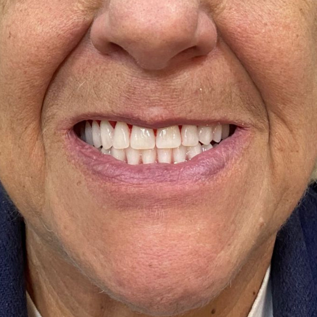 oral unic guapore - antes e depois (1)